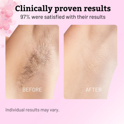 Plumera Cyperus Rotundes Oil